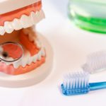 虫歯の治療　その5