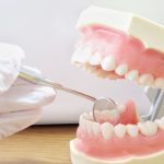 歯の延命
